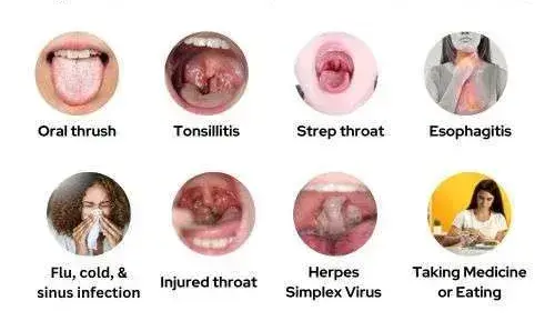 why does it hurt when i swallow