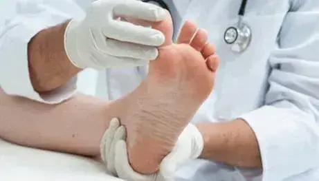 Diabetic Foot Exam picture depicting a doctor performing a Diabetic Foot Exam on a patient