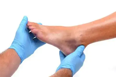 nerve biopsy picture depicting the gloved hands of a medical professional holding a patient's feet for nerve biopsy