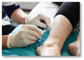 skin biopsy picture depicting a medical professional performing a skin biopsy on a patient's legs