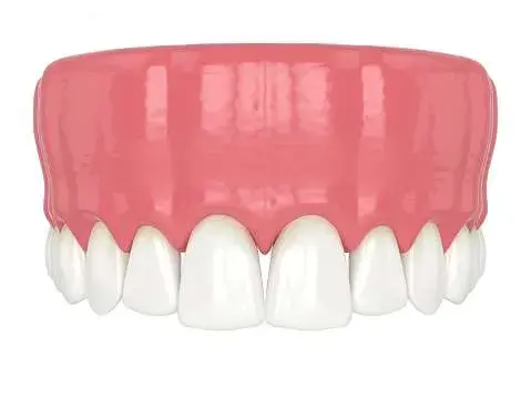 Cosmetic Bonding - how to fix a gap in teeth