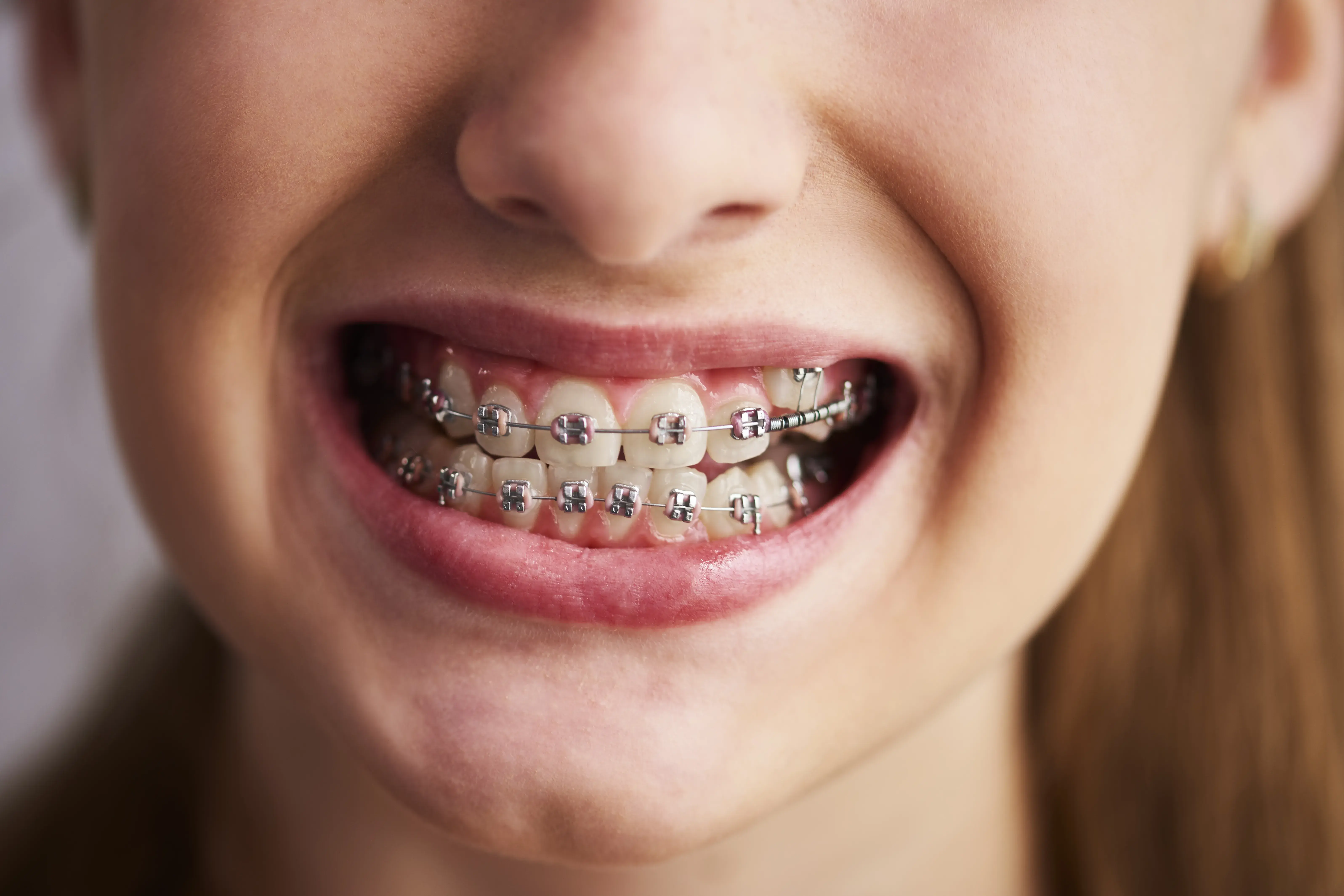 What Does An Orthodontist Do