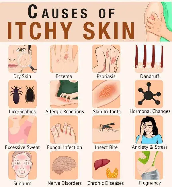 What causes skin itching