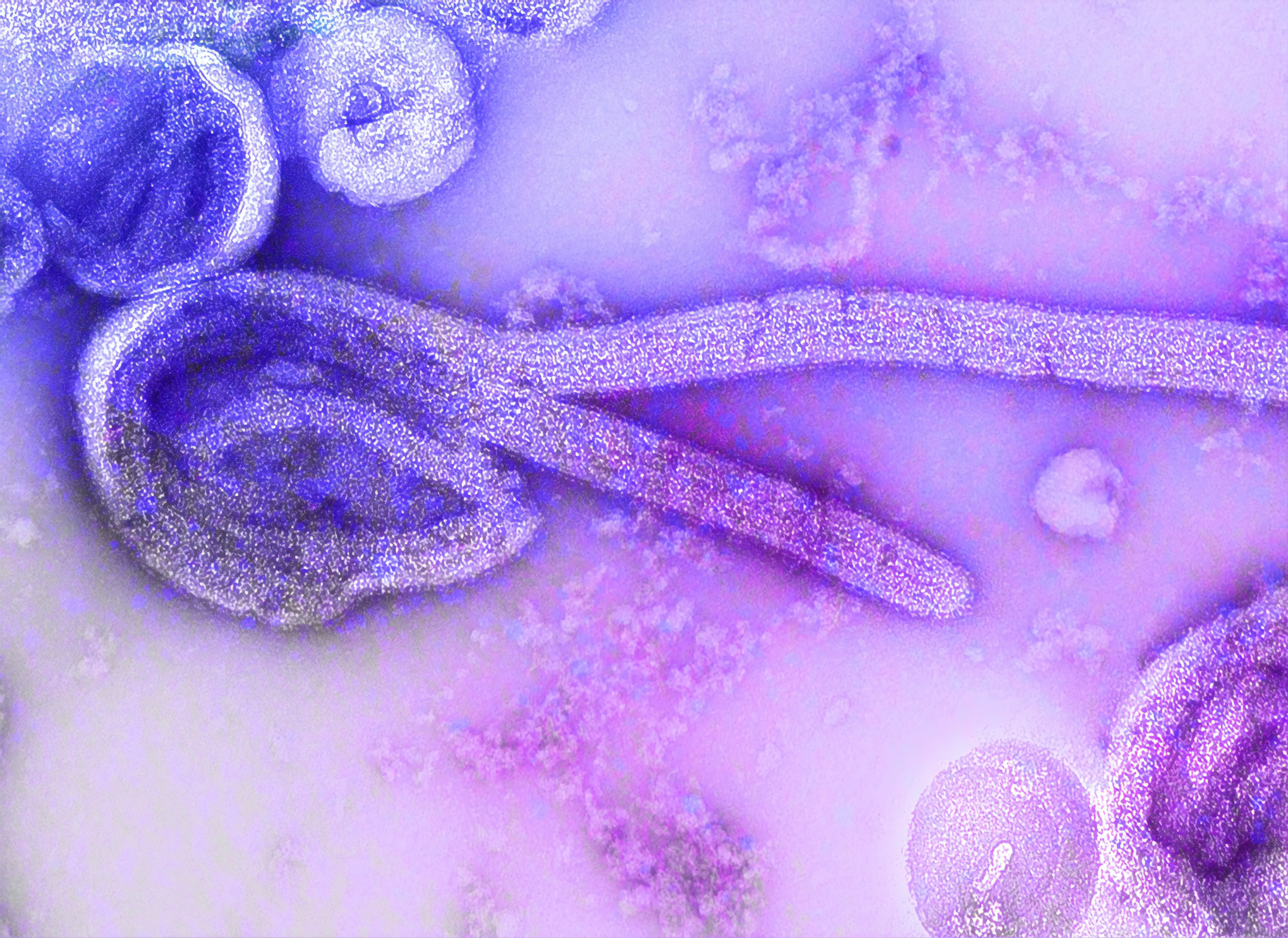 dengue fever