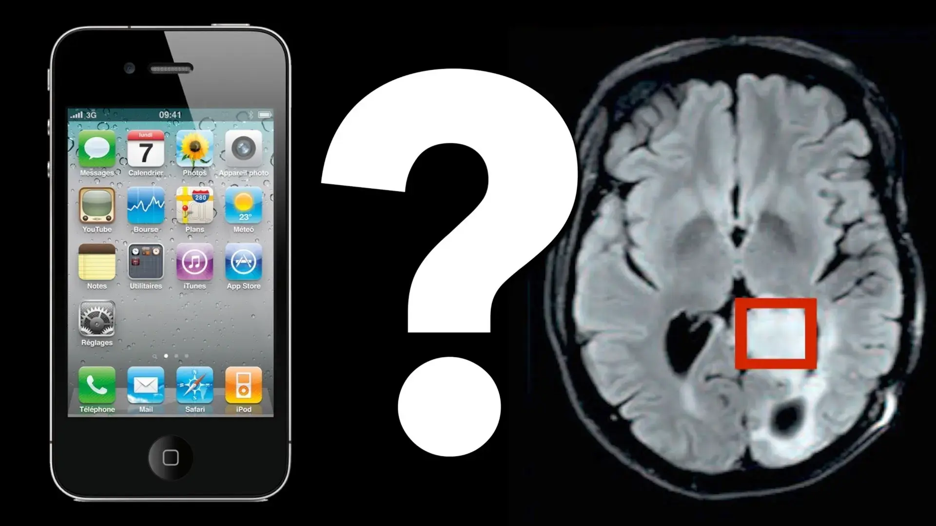 Mobile phone causes cancer