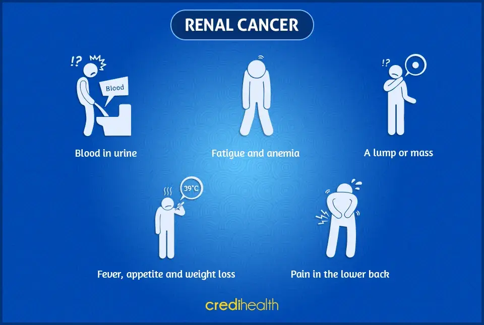 renal-cancer