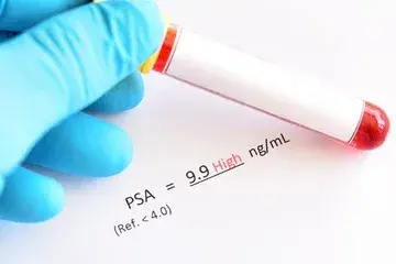 What is the normal PSA Level