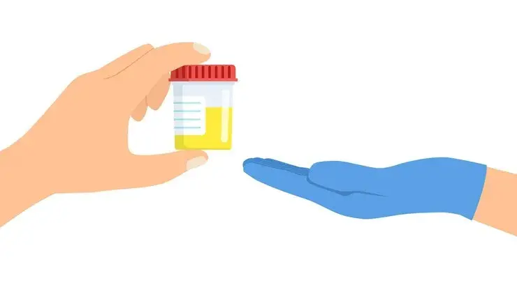 How Long Does Fentanyl Stay in Urine