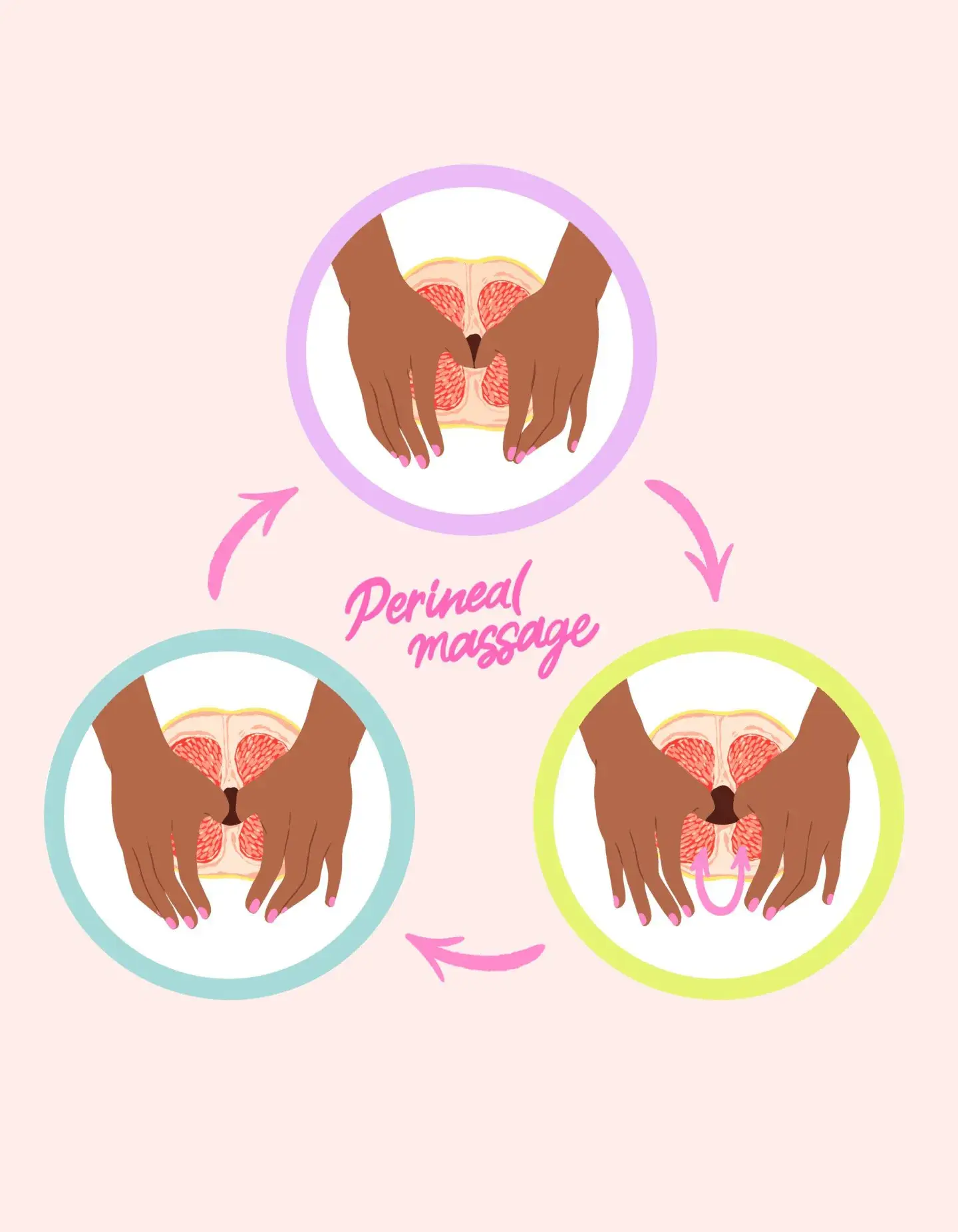 perineal massage in pregnancy