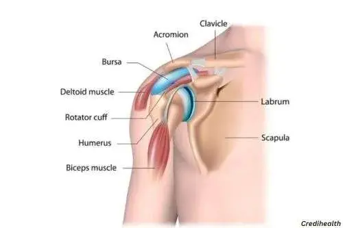 torn labrum recovery time