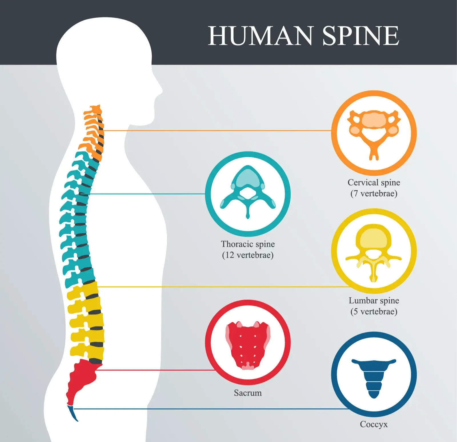 Fracture in vertebrae