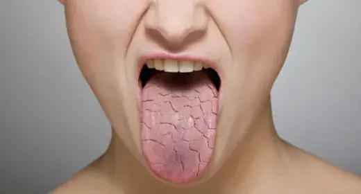 Bad Breath Treatment, How to get rid of Bad Breath, Home remedies for bad breath, bad breath remedies, How to avoid bad breath