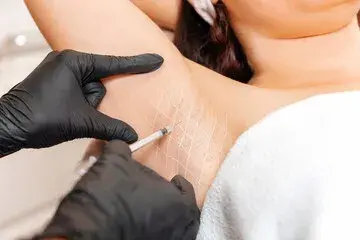 Injections for sweat: How to Sweat Less