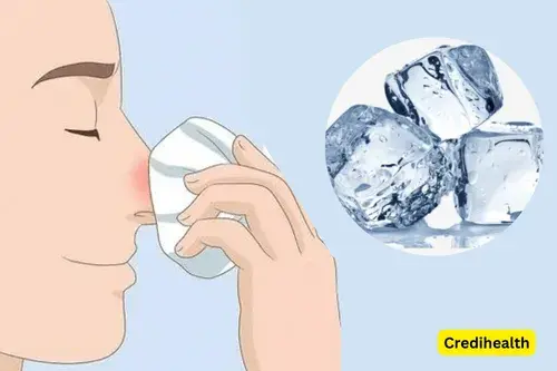 Use an ice pack - Reasons for Bleeding From Nose