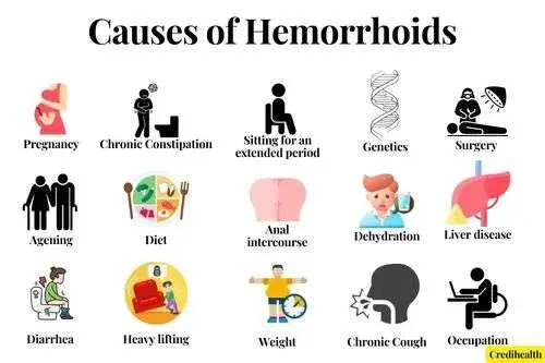 causes of hemorrhoids, hemorrhoids causes, what is hemorrhoids
