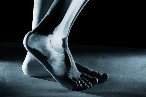 hairline fracture ankle