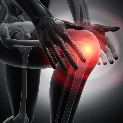 Knee Replacement Surgery