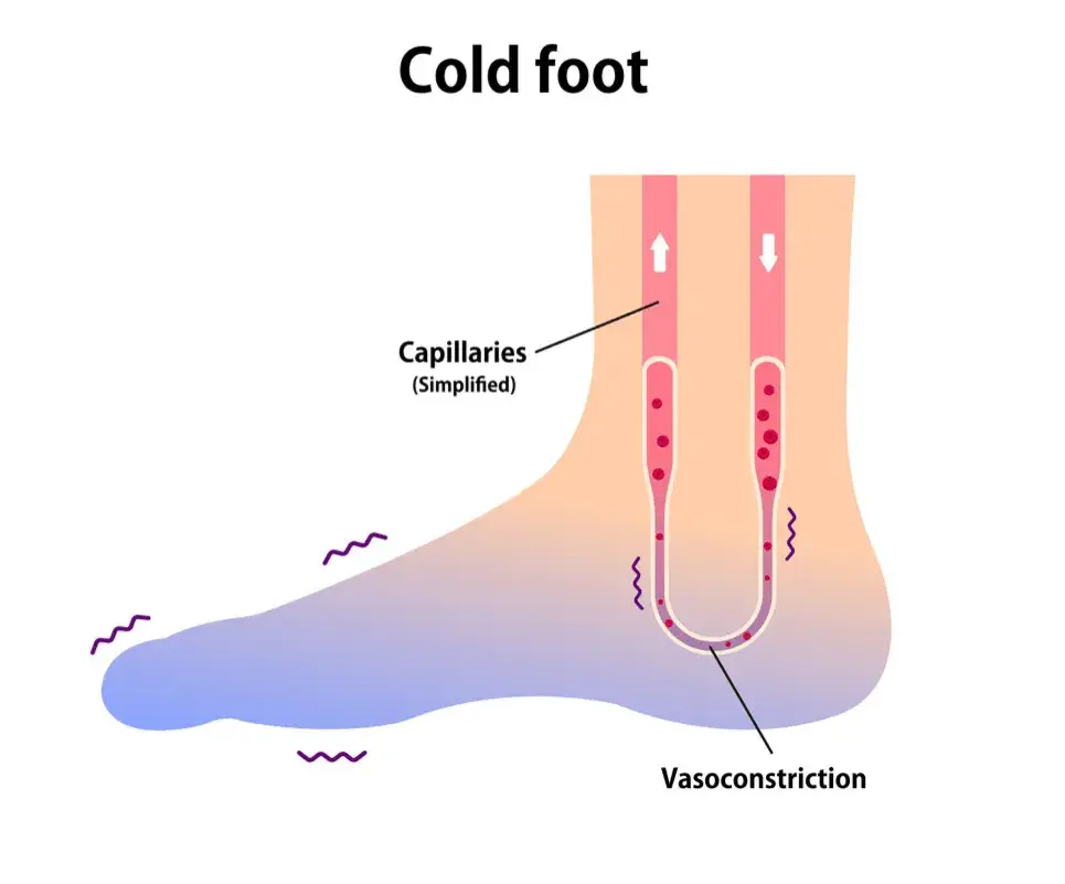 Cold Foot