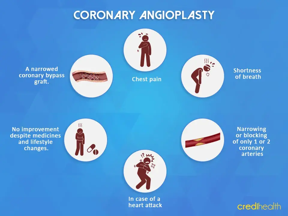 Candidate for Angioplasty