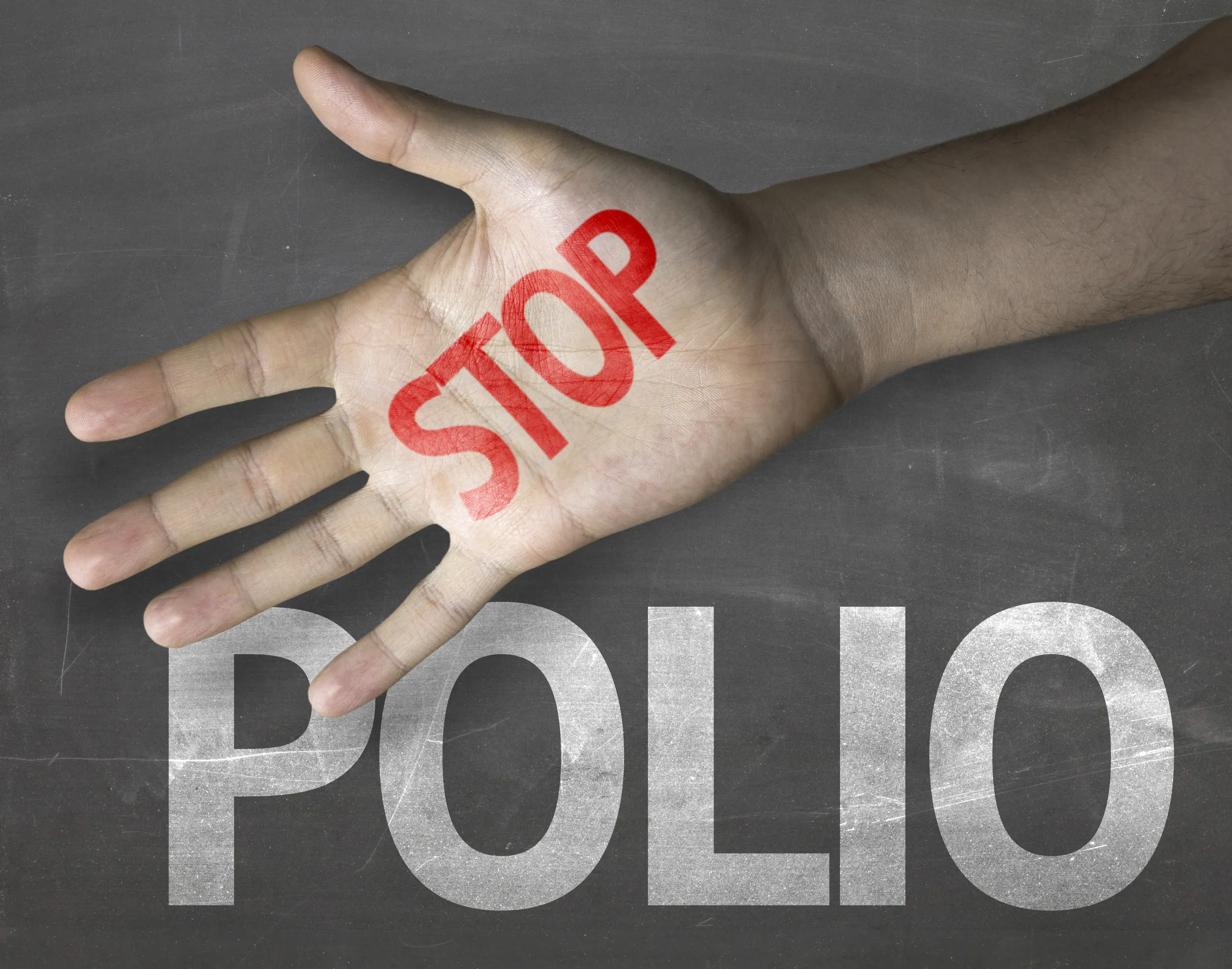 World Polio Day