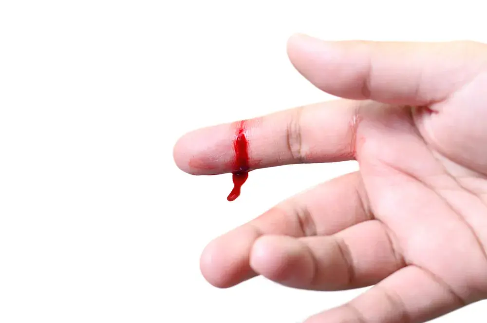 Haemophilia