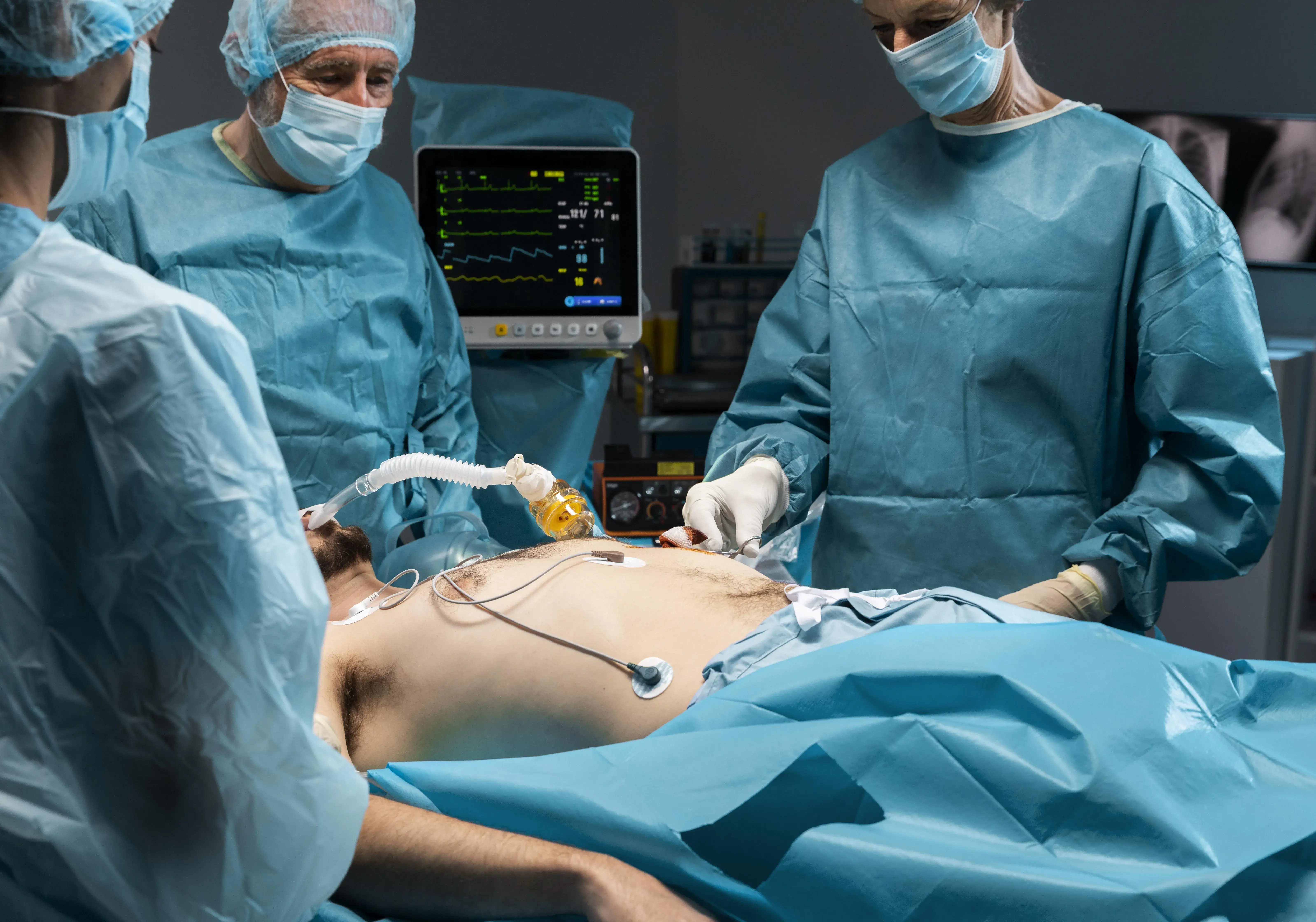 Laparoscopy