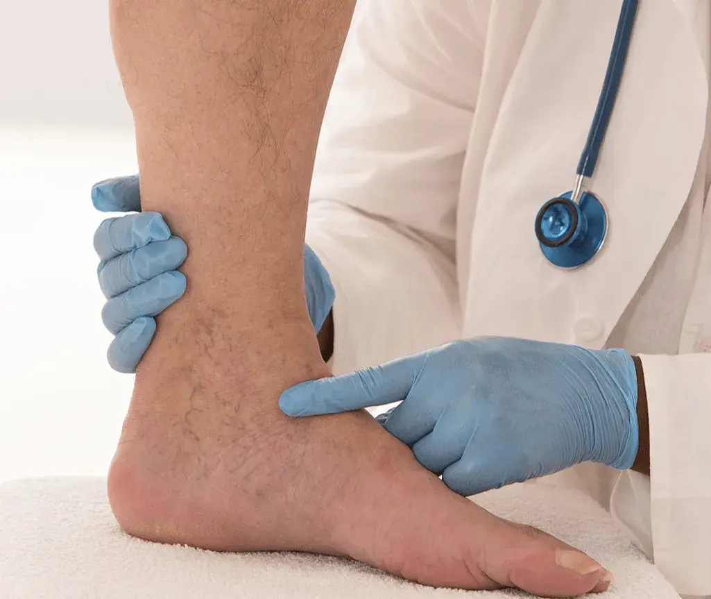 What is the risk of Blood clots in the legs