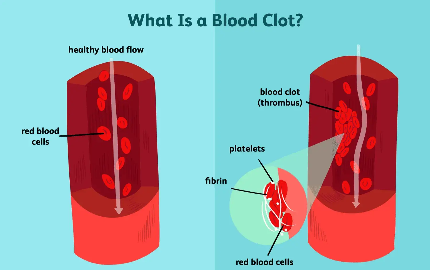 What is blood clothing