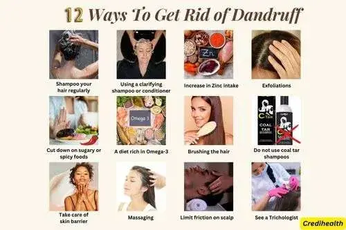 How to get rid of dandruff