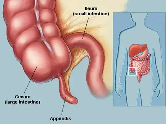Appendix