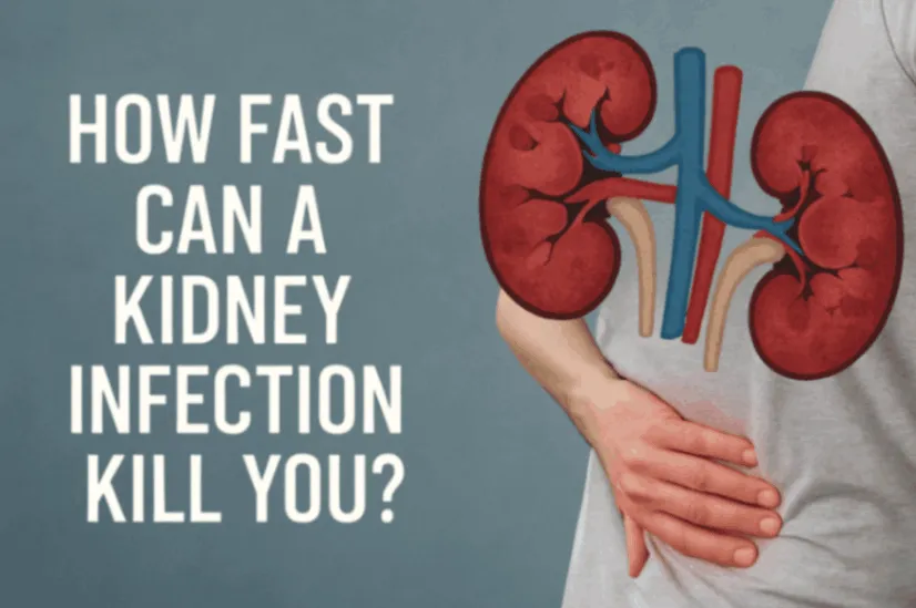 How Fast Can a Kidney Infection Kill You? What Doctors Wa...