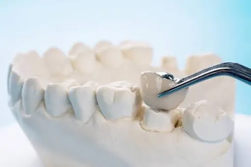 Understanding CDCP Coverage for Dental Cr...