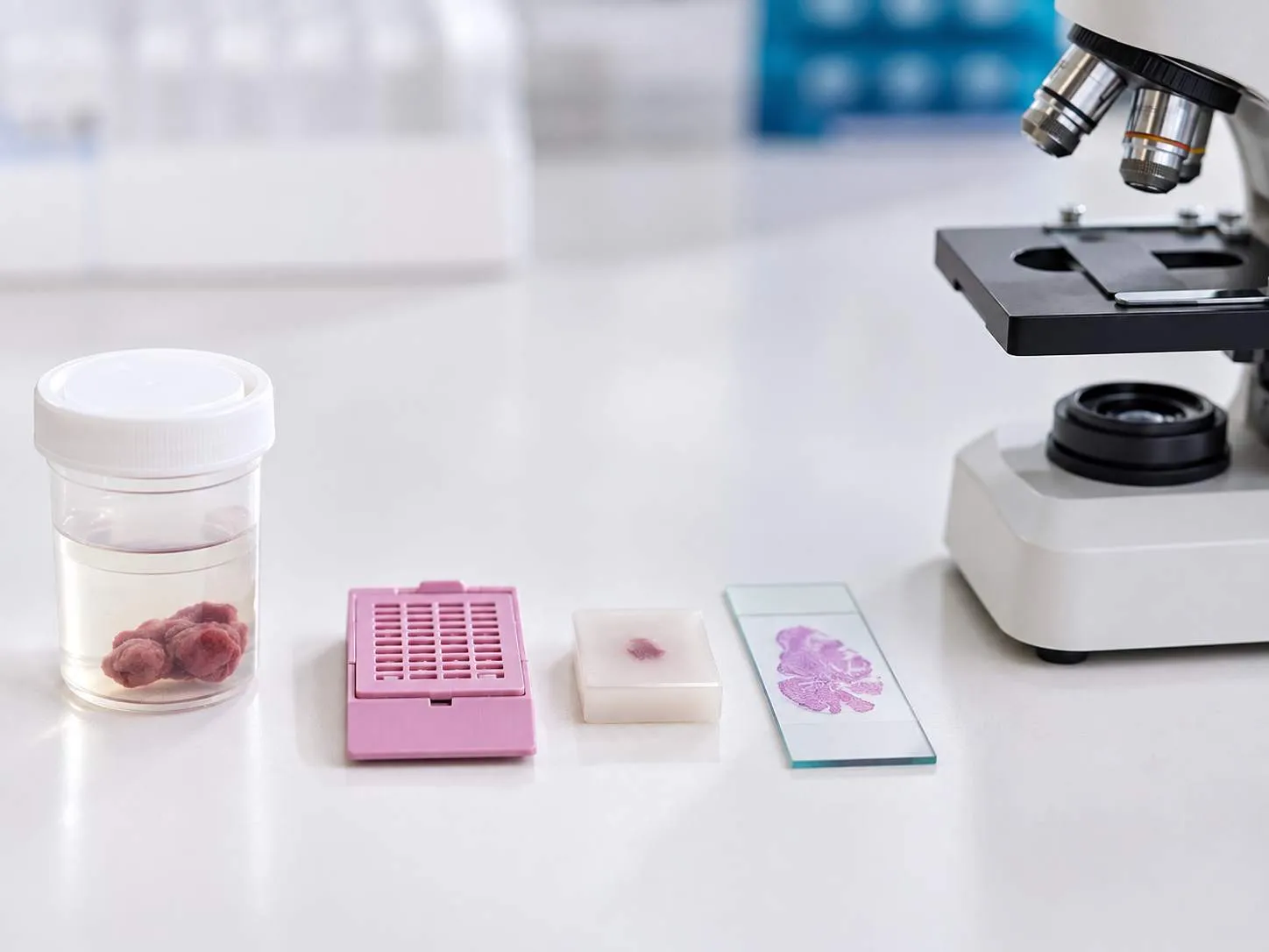 From Biopsy to Diagnosis: What Happens to...