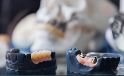 The Hidden Engineering of Tooth Replacement