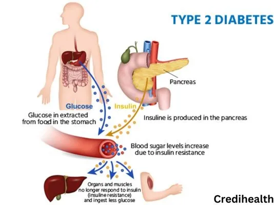 9 Unique Symptoms of Type-2 Diabetes. | Updated 2026
