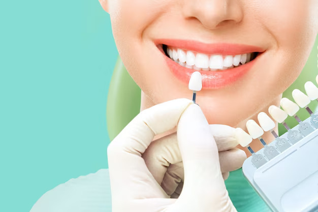 What are the advantages of dental veneers | Updated 2026